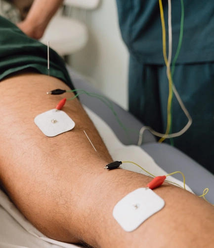 Fisioterapeuta de TAO Fisioterapia aplicando sesión de neuroacupuntura