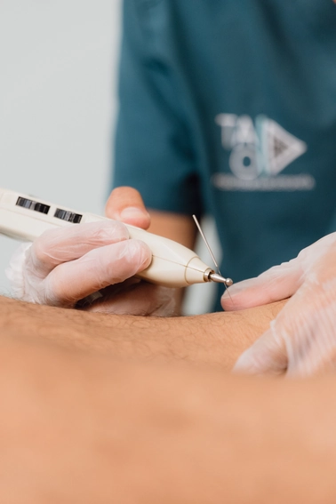 Fisioterapeuta aplicando Fisioterapia Invasiva Ecoguiada en Jerez